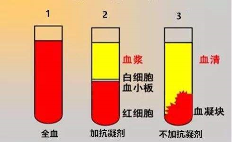 血浆颜色偏黄图片