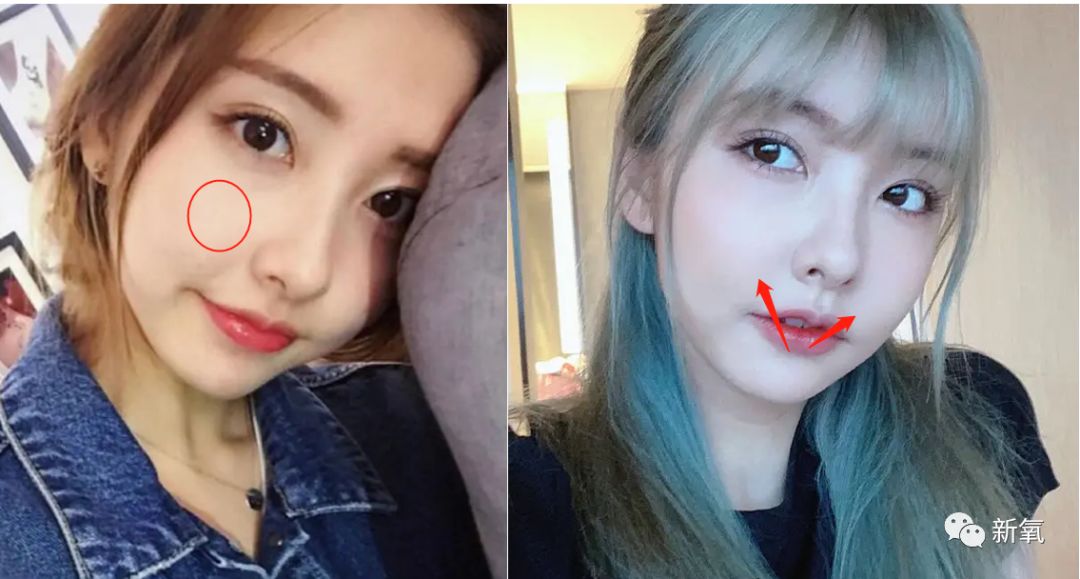 严肃分析原生条件那么好的豆得儿为什么越来越脸崩鼻孔缩没了