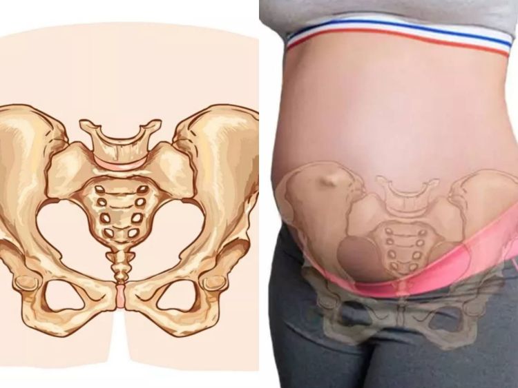 孕妇耻骨痛位置图图片