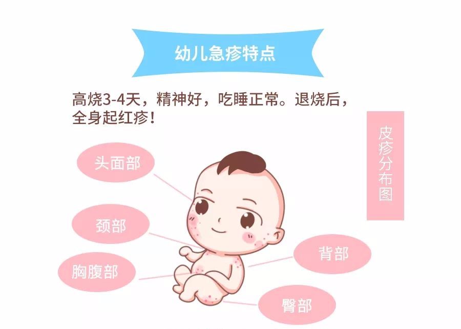 寶寶還是難免生病,比如幾乎每個寶寶都會經歷的一次發燒——幼兒急疹