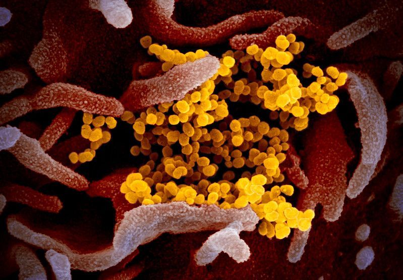 新冠病毒细胞图片
