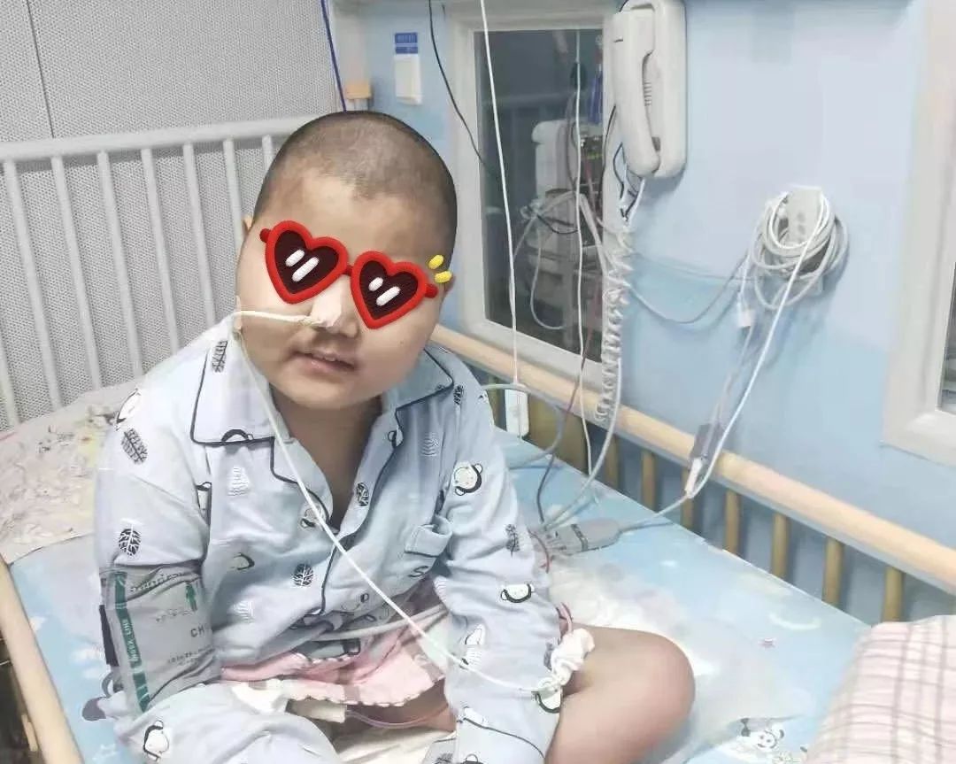 患者故事慢性活动性eb病毒感染患儿并发胰腺囊肿如何转危为安