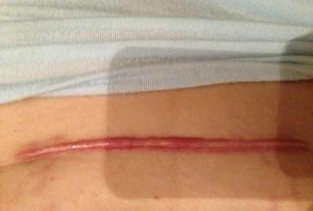 剖腹产怎么恢复身材破腹产后多久可以减肥看看你做错了什么