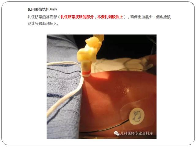 新生儿脐血管导管操作程序