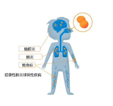 85%,健康的成人也可能是攜帶者,即使寶寶不出門,也可能通過大人接觸到