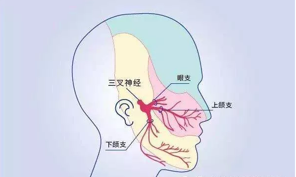 【診前須知】三叉神經痛切不可為了止痛過量用藥