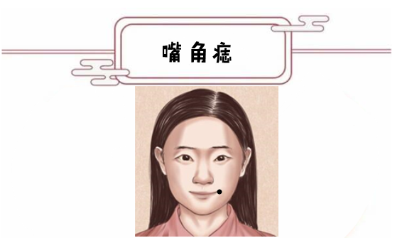 女人五颗薄命痣,不同痣相命不同!