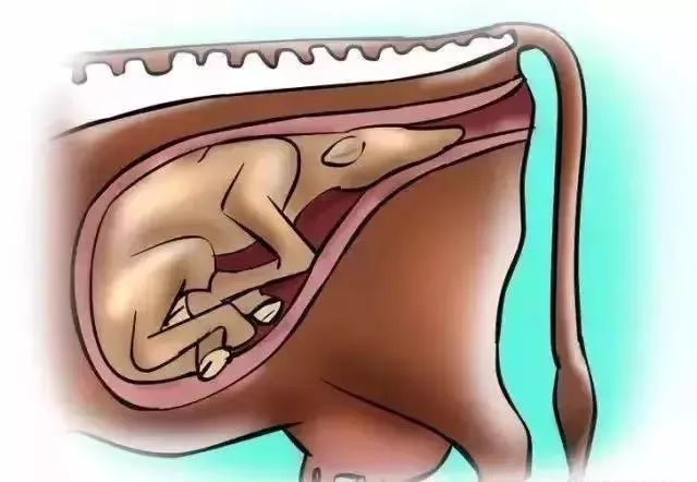 耻骨松弛激素,将会促进子宫颈结缔组织的软化,并增加骨盆韧带的弹性