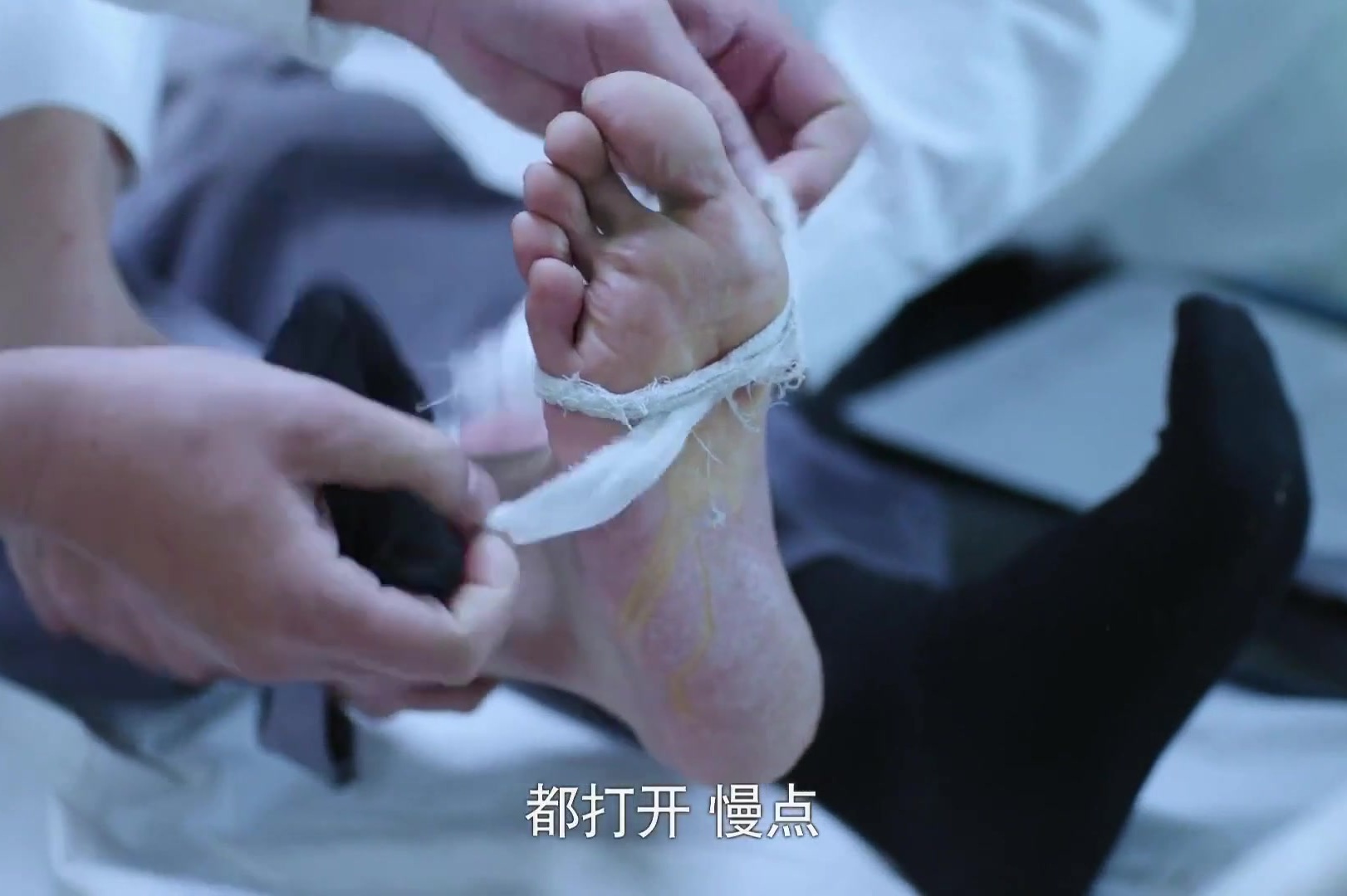 这种外伤不容忽视小伙子在工地被钉子扎到自己随便包扎险些丧命