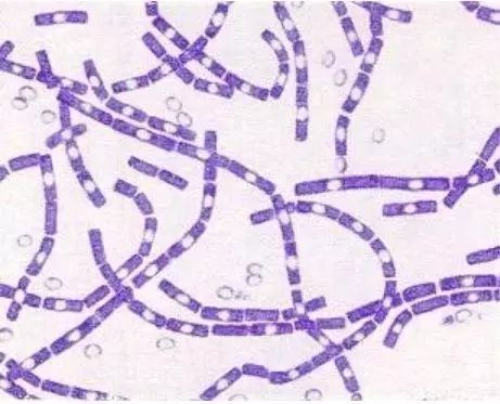 高倍显微镜下的杆状菌体及芽孢(来源:炭疽可怕吗?