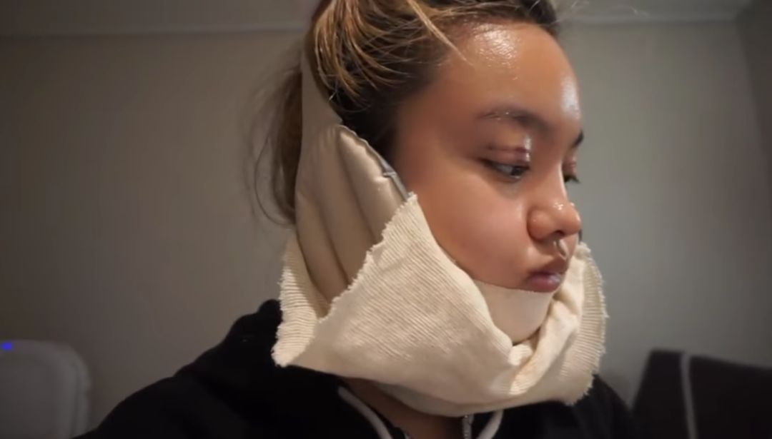 她录下自己前往韩国整容的整个过程这条所谓变美的捷径感觉也不容易