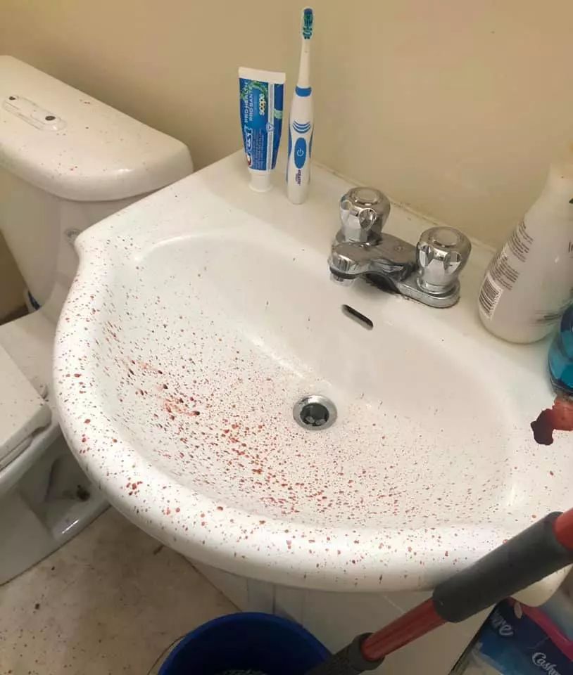 洗手盆有血的真实照片图片
