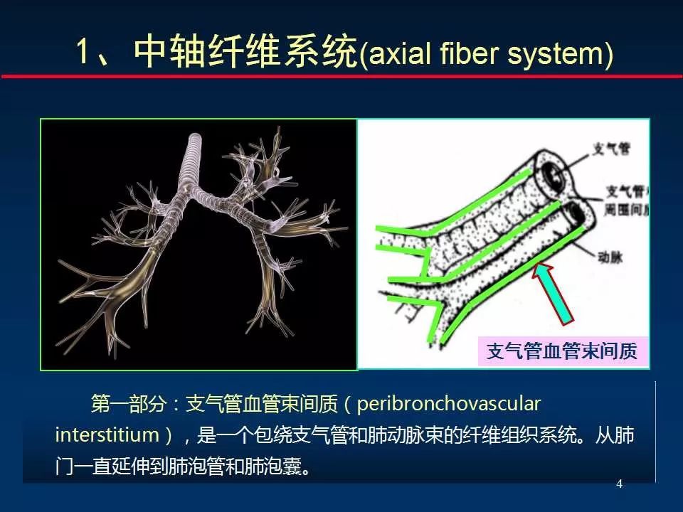 肺間質是指肺的纖維結締組織構成的框架結構,包括:各級支氣管和血管