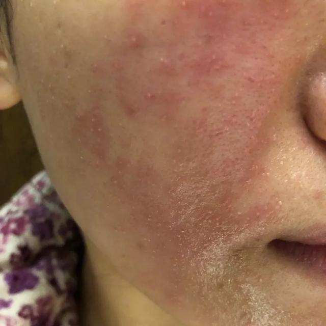 春敏最最最最最应该做的三件事