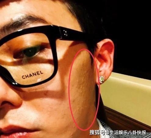 原创权志龙是有多穷鞋带绕两圈就成了领带蜂窝脸更是令人感慨