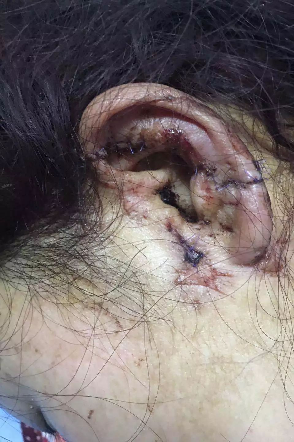 院工作人员郭秀英,在去八角楼乡维地村开展新冠肺炎疫情防控工作时,在