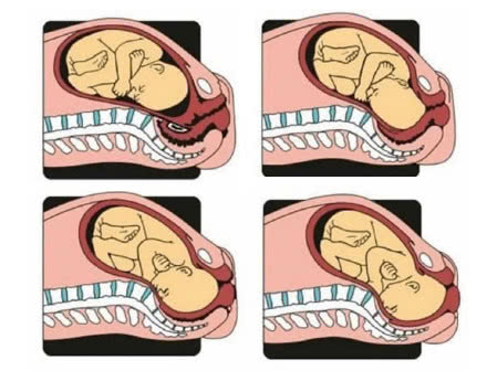原创胎儿入盆后是要生了吗别急这三个信号说明胎儿真的要生了