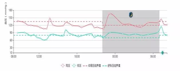 人体血压24小时走势图图片