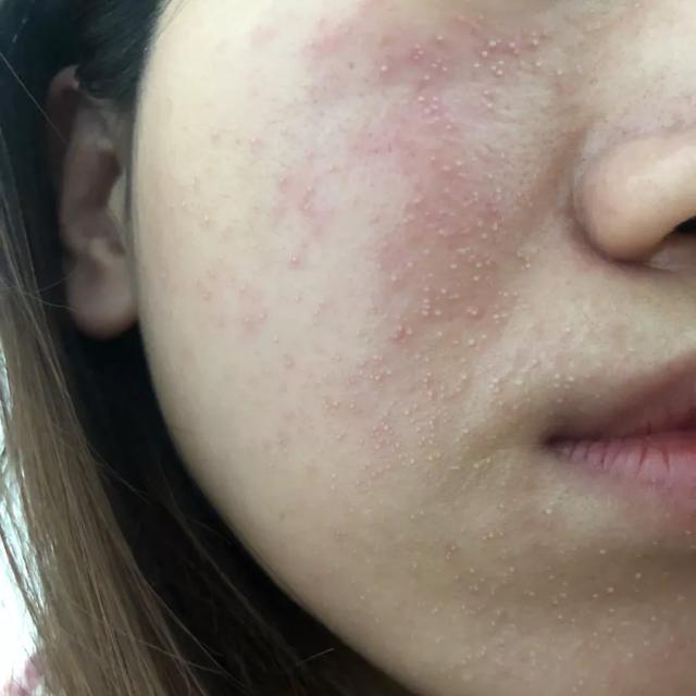 春敏最最最最最应该做的三件事