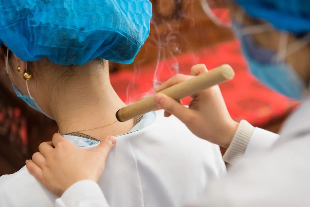 治未病科推出强身防疫中医特色疗法_艾灸法
