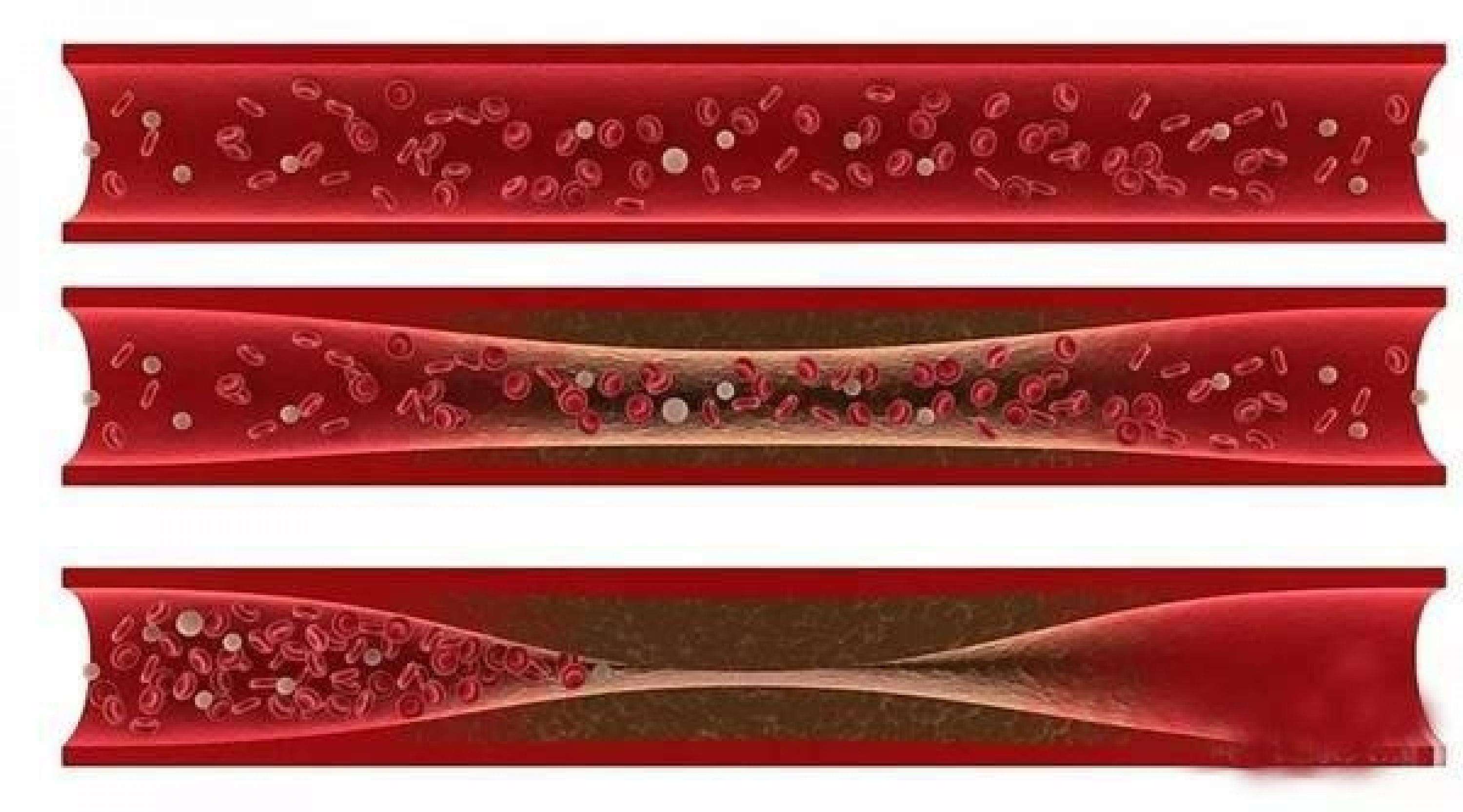 心脑血管病为何高居疾病死亡之首居家老人如何防治善孝管家