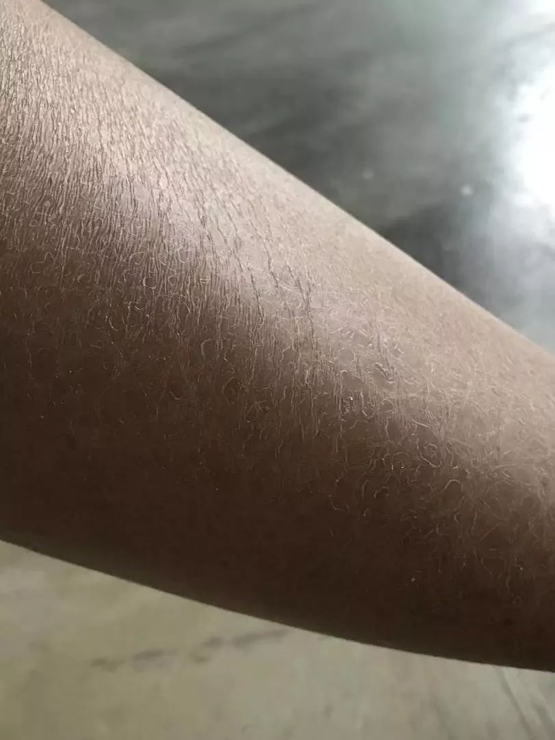 李佳琦疯狂打call的这瓶全能小绿膏不到50块竟然一次搞定糙皮干裂湿疹