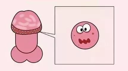 的是,白斑有恶变的可能性,所以,有包茎或者包皮过长的生殖器白斑患者