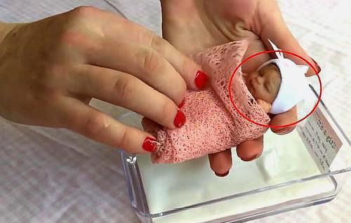 世界上最小的婴儿,真实版"拇指姑娘",她现在怎么样了_saybie