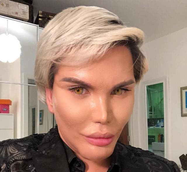 全球整容最疯狂的男子全身除了脑子全部地方都整了容