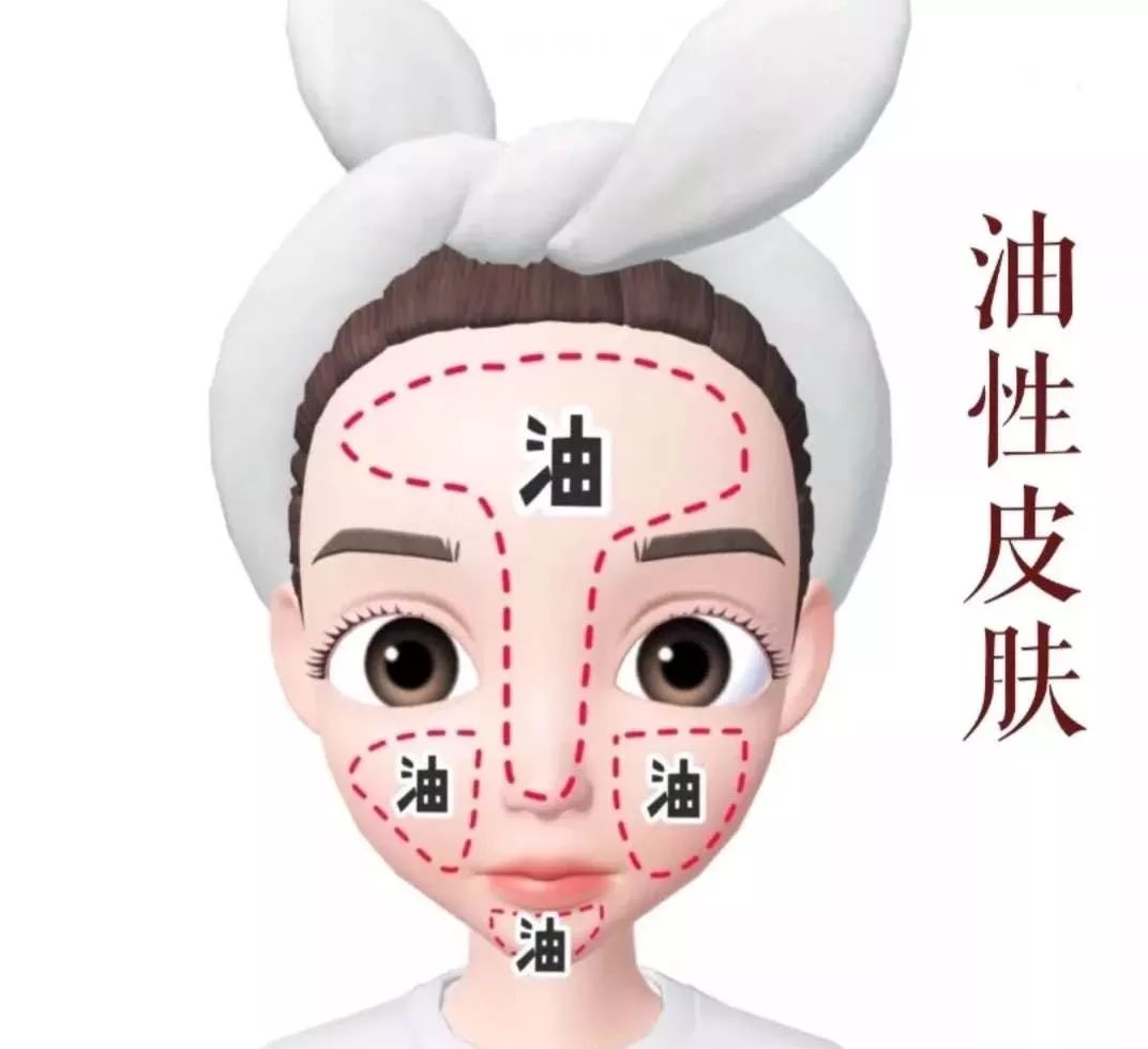 油皮特征:t区和两颊都很爱出油★油性皮肤:注意清洁重要的事情说三遍!