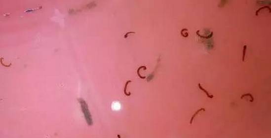 【今日头条】 水中有"红虫"是怎么回事?