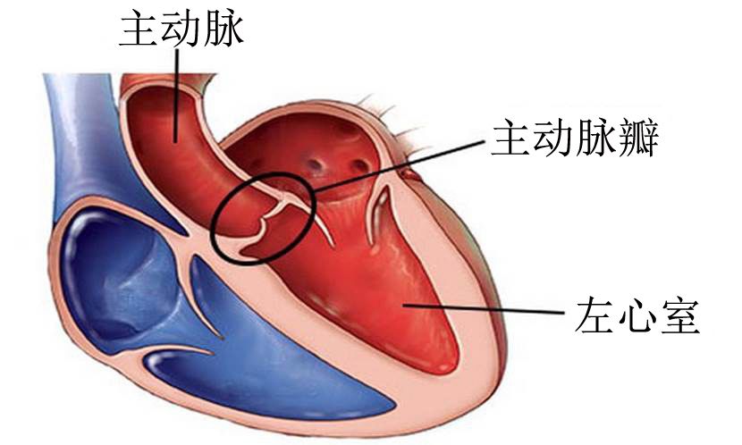 正常心脏瓣膜解剖图图片