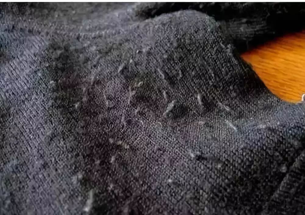 毛衣大衣起球怎么办有了这款衣物去毛神器旧衣秒变新款