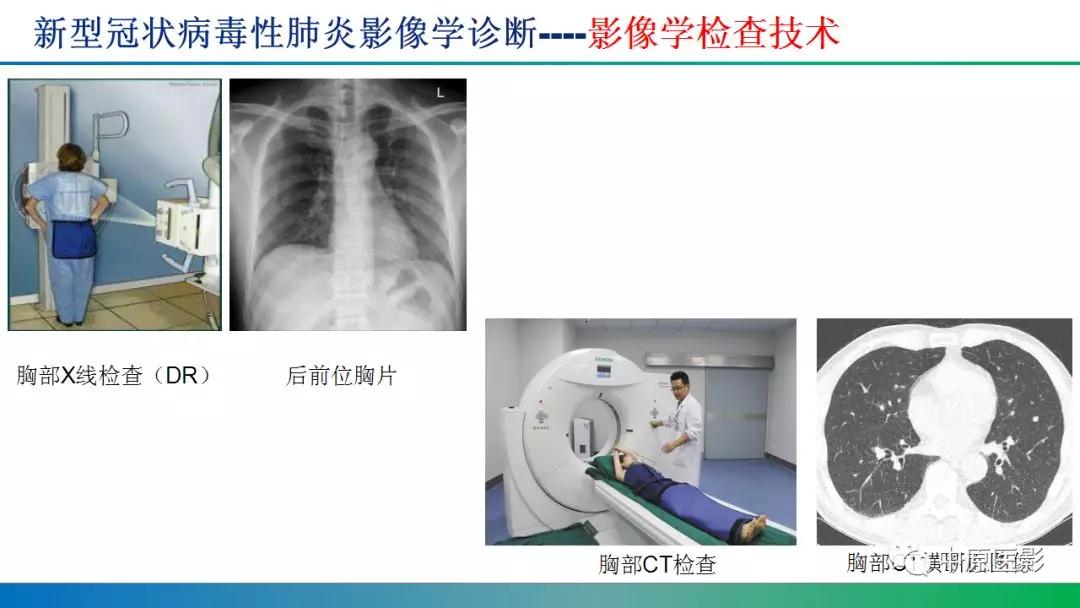 新型冠狀病毒肺炎影像學診斷淺析