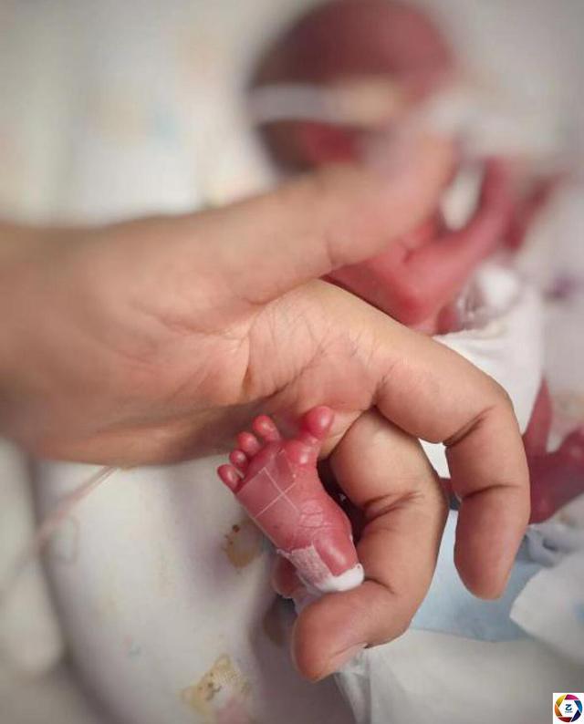 早产八个月出生的图片图片