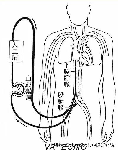原来新冠肺炎被治愈的真相是这样你阅读健康将离你越近深度阅读