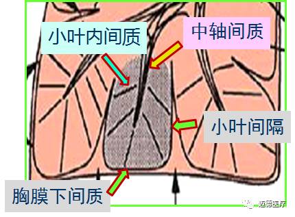纤维网(network)间隔纤维组织(小叶内间质)3胸膜下间质和小叶间隔组成