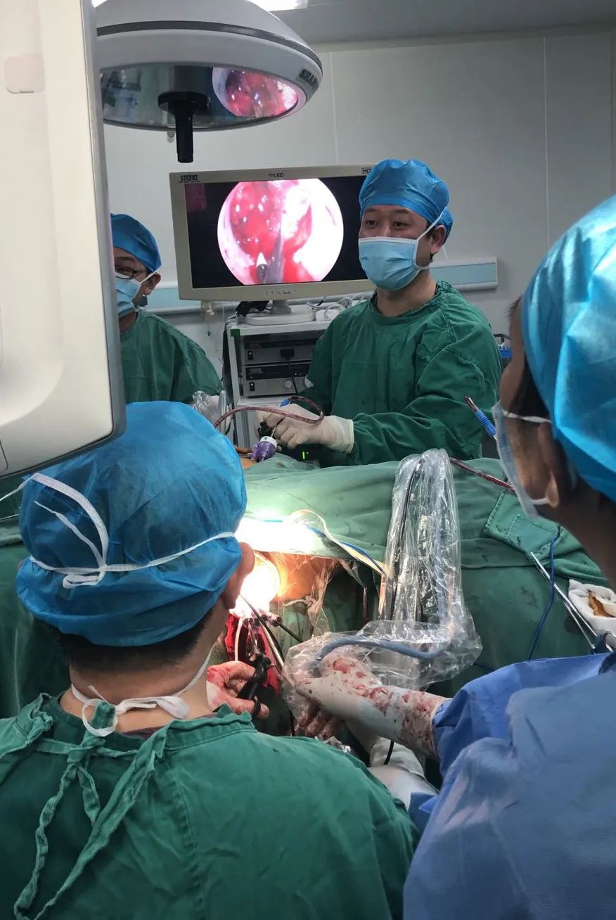 疫情之下肿瘤患者及时完成微创手术治疗