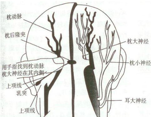 颈部软组织引起"枕大神经痛"原因及处理策略_肌肉