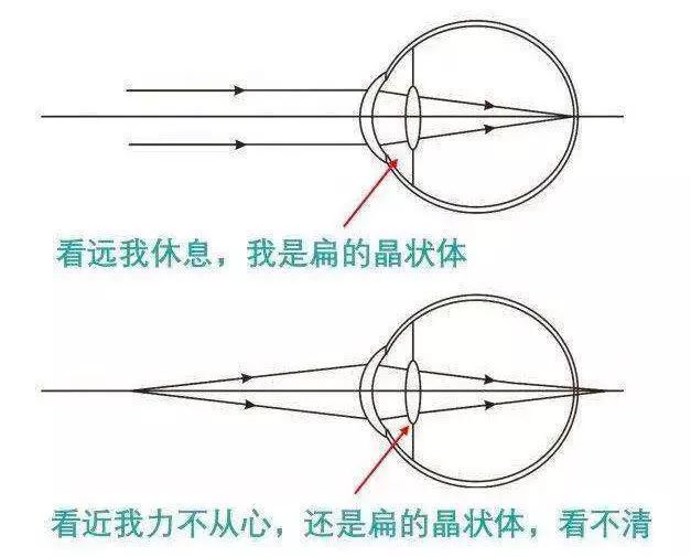 老花镜原理图片