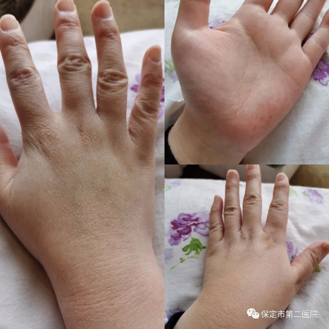 连线出征武汉战士——张杏:短暂的离别为了更好的重