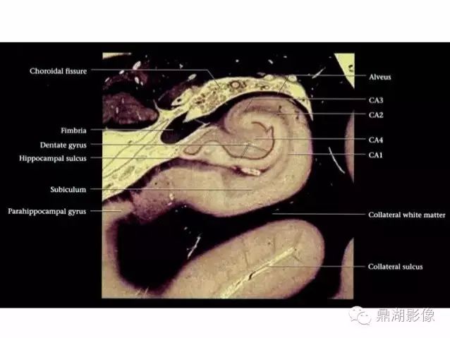 海马区断层解剖图片