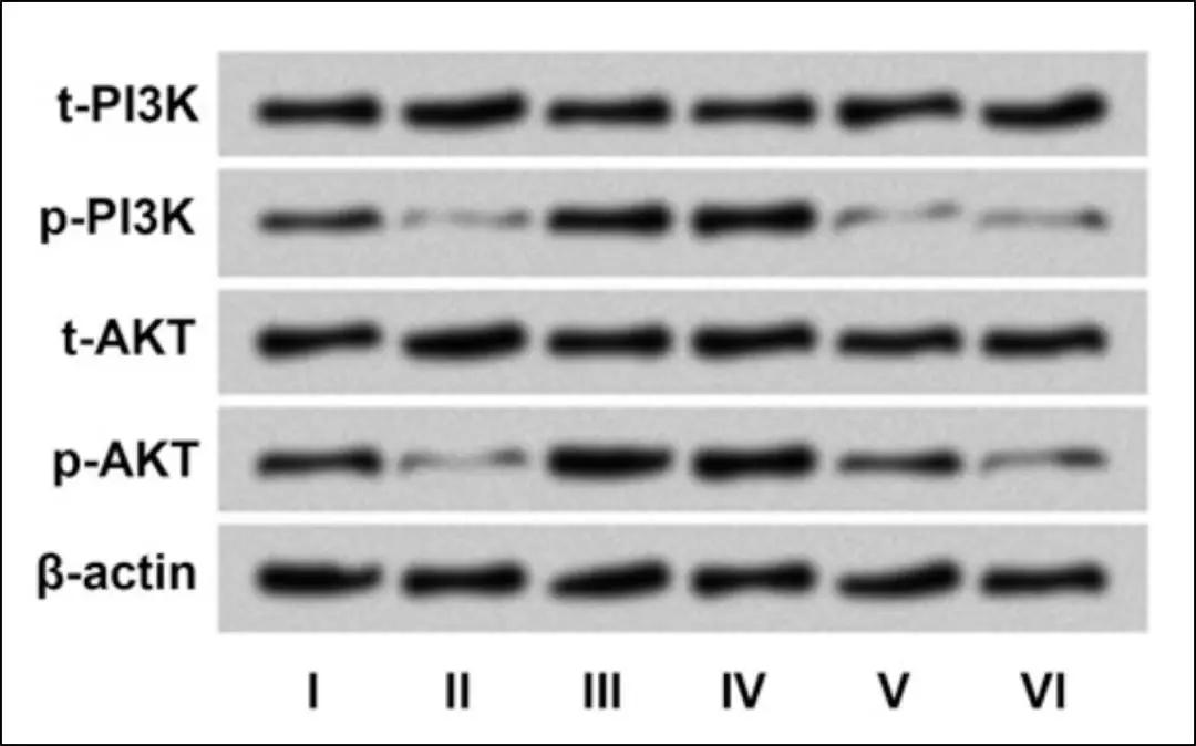 caspase9条带图片