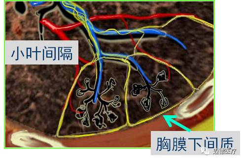 間質)2小葉中心間質支氣管血管周圍間質中軸纖維系統的位置第二部分