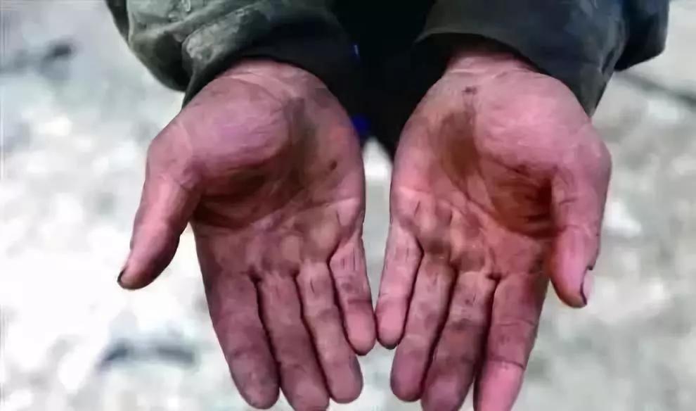 这是一双标准的汽车修理工的手,一年四季都这样1. 不怕脏