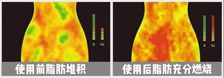 这些成分能进入皮下脂肪层可以加速燃烧脂肪