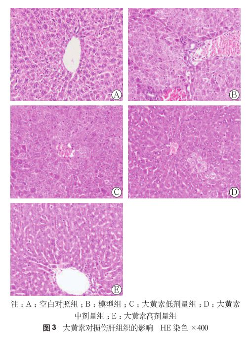 肝细胞和完整的肝组织结构,模型组示大量炎性细胞浸润和肝脏结构破坏