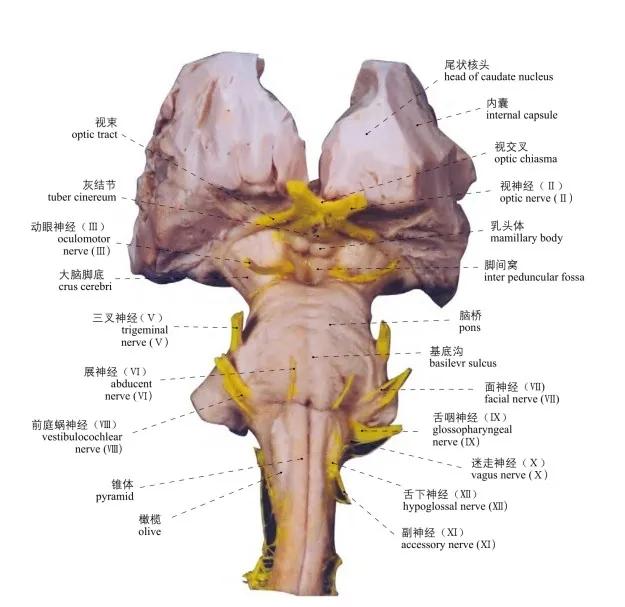 脑干腹面观图片