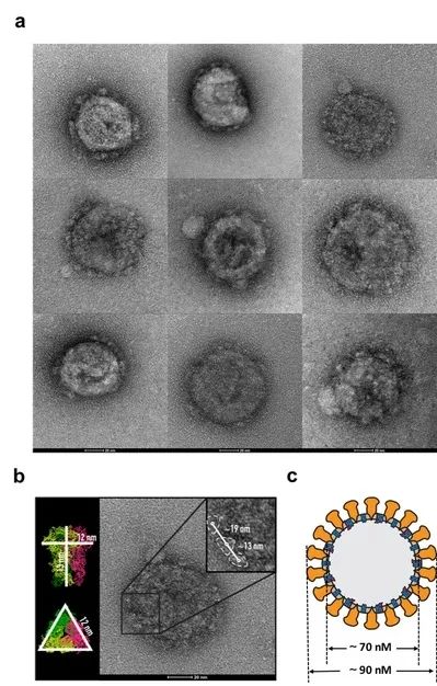 电镜观察下的mrna疫苗产生的新冠病毒样颗粒研究团队在总结非典病毒