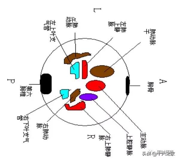 胎儿心脏三血管切面详解